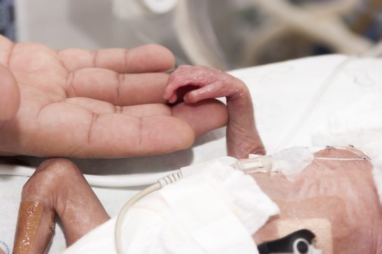 Saúde - geral - bebê prematuro - UTI Neonatal - bebês internados após parto precoce